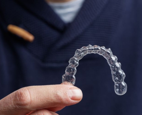 nakładka invisalign