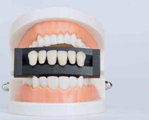 wizualizacja licówek