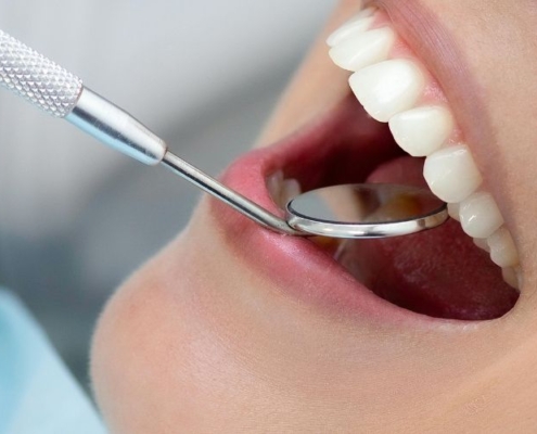 Badanie stomatologiczne przy użyciu lusterka.